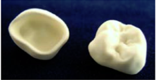 3D Printed Dental Restorations